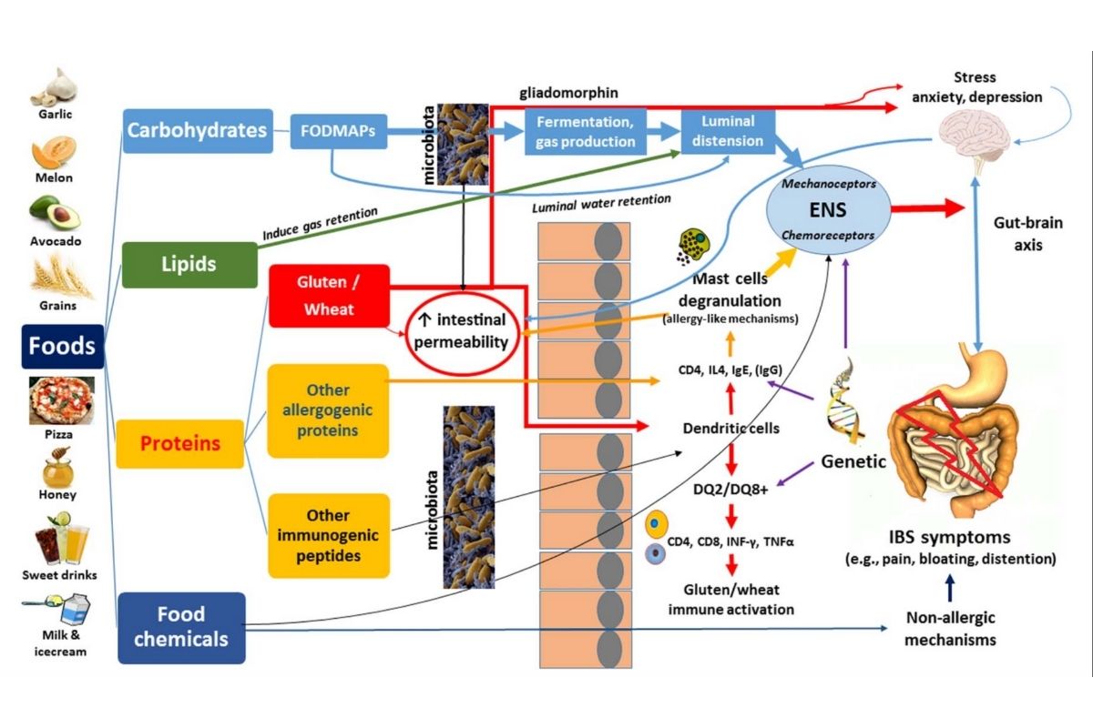 How our diet contributes to digestive ailments and affects Gut and Brain Health Celiac Disease